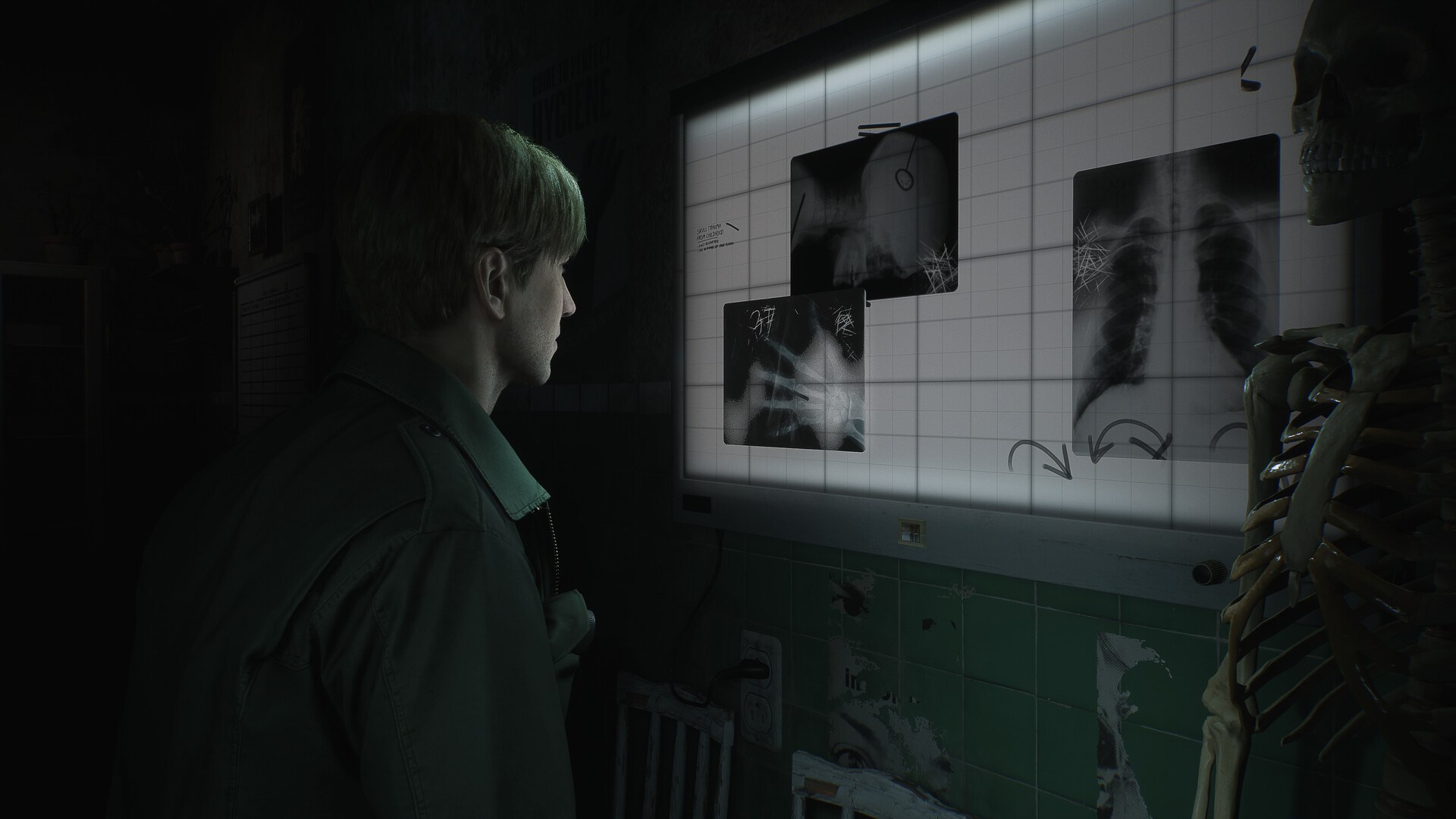 Silent Hill 2 Remake İçin Yeni Hikaye Fragmanı Yayınlandı